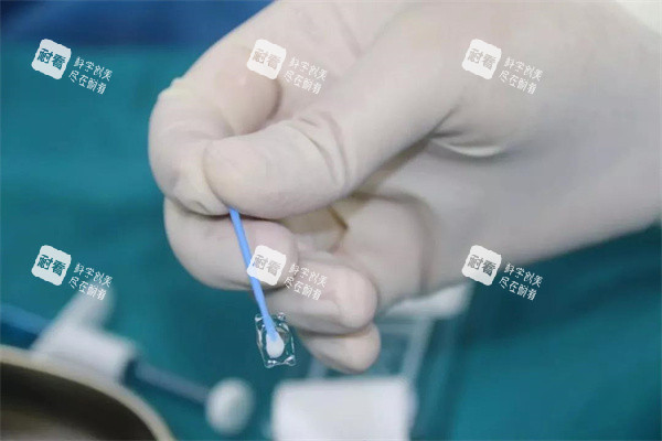 icl人工晶体真实图 icl人工晶体真实图