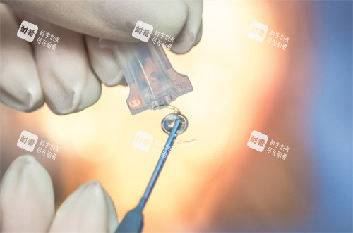 强生ICB00晶体取出