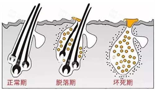 头发生长周期图解 头发生长周期图解
