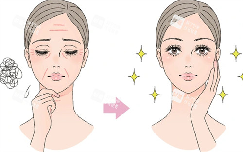 抗衰管理前后对比图