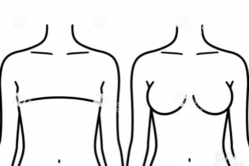 隆胸前后对比图一览 隆胸前后对比图一览