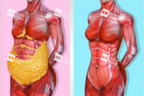 腹部脂肪消除卡通图 腹部脂肪消除卡通图