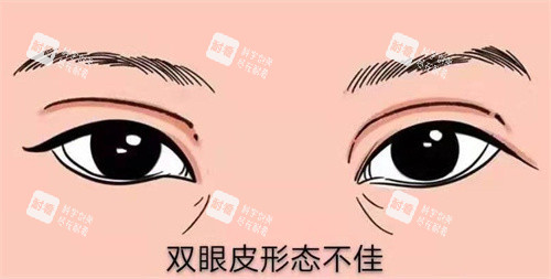 肖阿能眼部修复口碑爆棚!揭秘2000+真实病例背后的自然美学