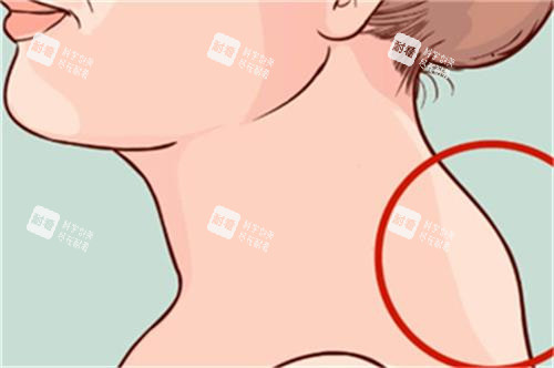 从侧面看富贵包的位置 从侧面看富贵包的位置