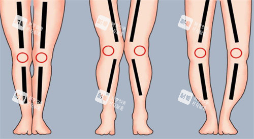 腿型动画图片