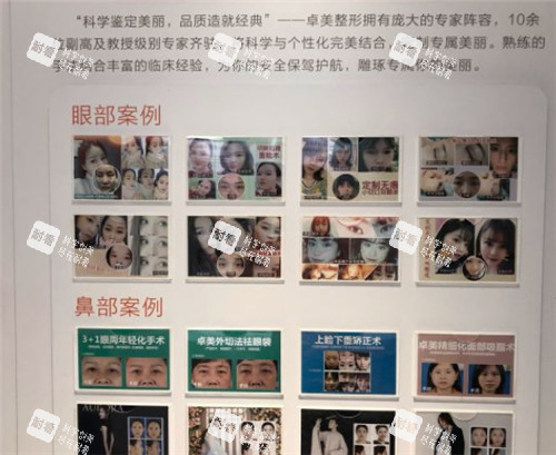 武汉硚口卓美整形展示墙