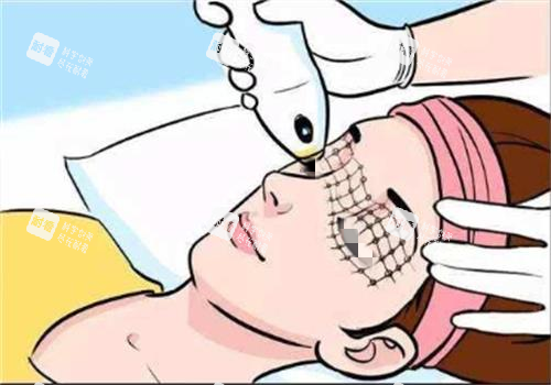 光子嫩肤过程图