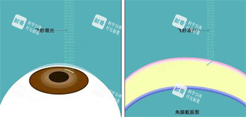 飞秒激光展示图示