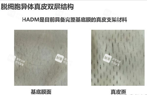 3d生物束带紧缩术材料结构示意图