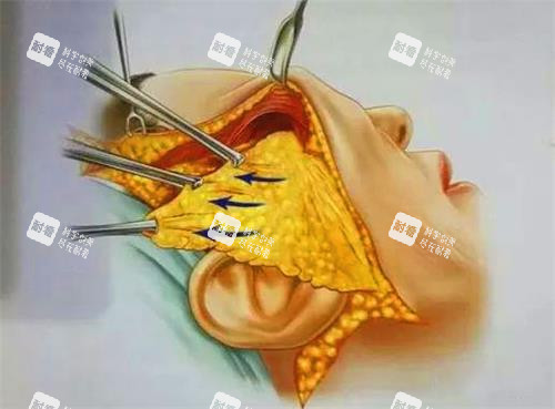 拉皮袁强在北京哪个医院？朝阳区两大机构，地铁/自驾路线+坐诊时间+线上预约通道直达