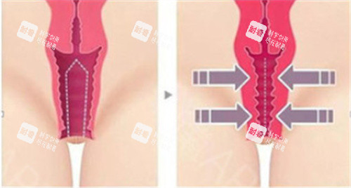 呼和浩特私密紧缩针医院盘点:京美|春和|华医|亚太,哪家更适合你?