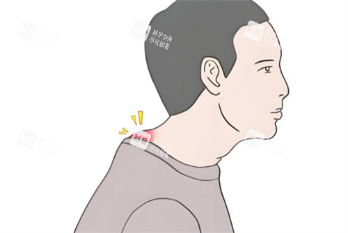 富贵包手术医院怎么选?13家热门机构技术特色|价格|医生信息全方面剖析