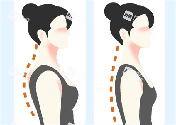 富贵包矫正手术