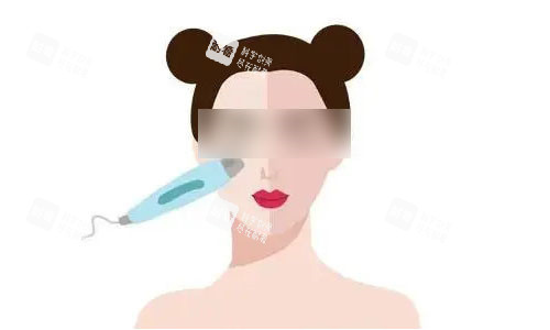 光子嫩肤流程图