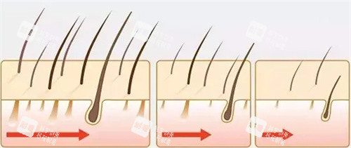 毛发生长方向细节动画图