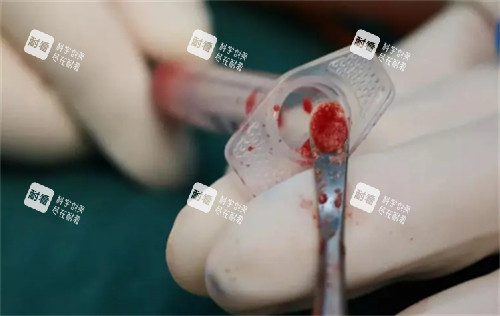 取出不明注射物