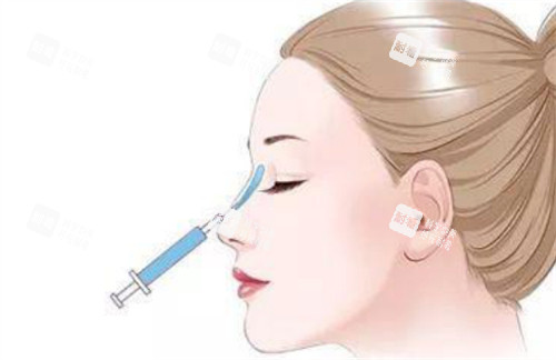 微晶瓷注射隆鼻过程 微晶瓷注射隆鼻过程