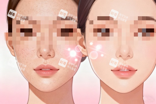 祛斑前后对比图