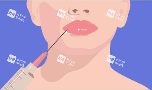 注射美容卡通图 注射美容卡通图