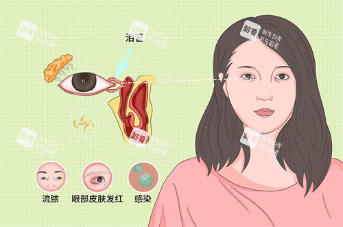 泪道阻塞常见的反应