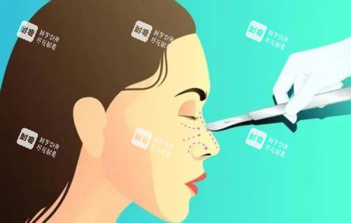 隆鼻失败修复示意图