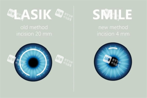 全飞与半飞 全飞与半飞