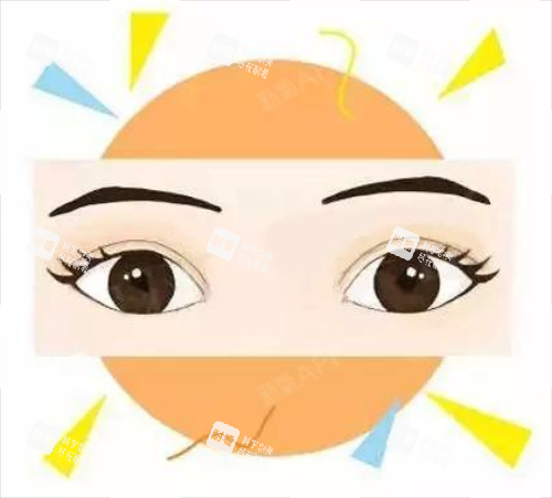 全切双眼皮效果图