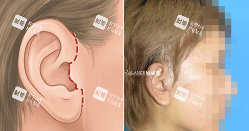 北京加减美穆宝安医生技术好吗？专注面部提升30年，中韩明星御用！