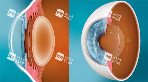 晶体植入的层次 晶体植入的层次
