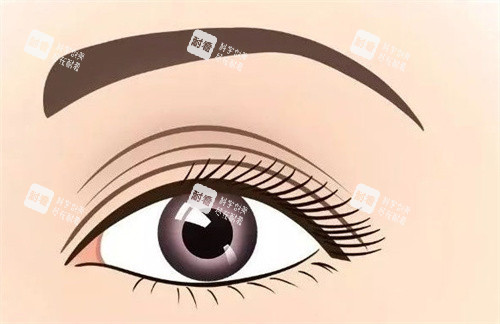 杜园园高难度眼修复技术解析：卧蚕重塑+双眼皮修复，拯救失败术例