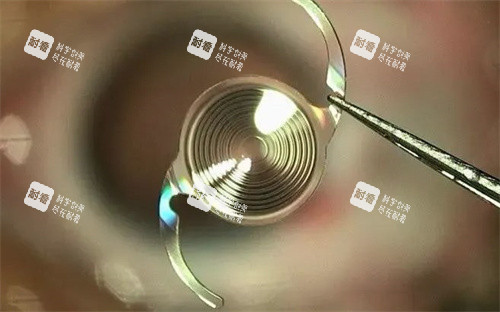 多焦点人工晶体