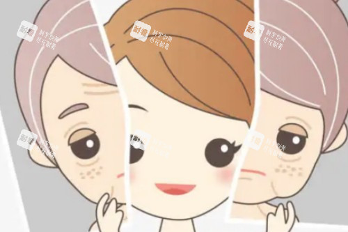 面部提升卡通展示图