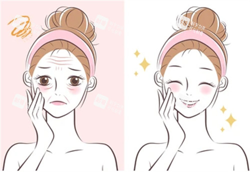 抗衰管理前后的对比图片 抗衰管理前后的对比图片