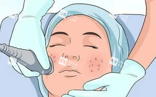 面部美容卡通示意图 面部美容卡通示意图