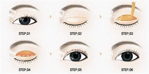 成都美茵医疗美容医院收费标准，包含眼部、鼻部、胸部、吸脂、皮肤等新项目价格全介绍！