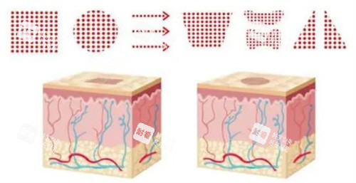 点阵激光出光模式