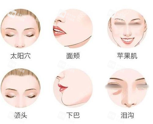 面部填充部位一览图