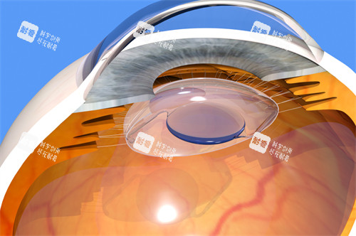 人工晶体 人工晶体