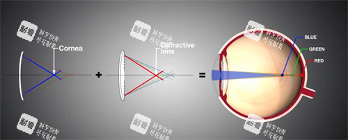 2026爱尔眼科晶体植入手术价格表：ICL/TICL晶体多少钱？附官网更新收费明细表