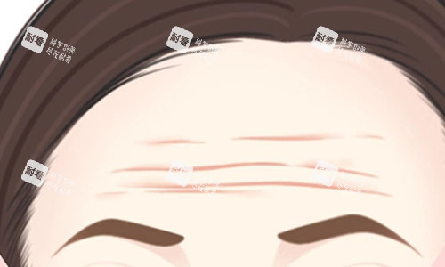 抬头纹的动画图