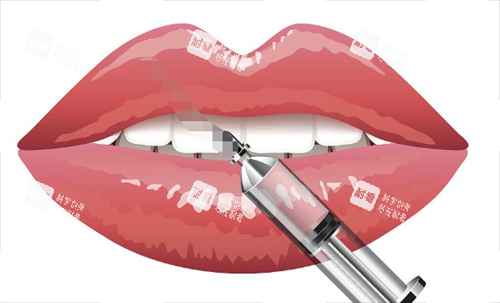 玻尿酸注射嘴巴动画展示