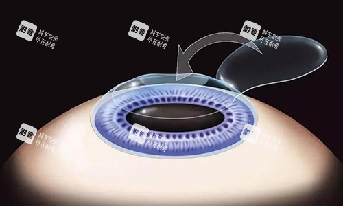 激光改善展示图照