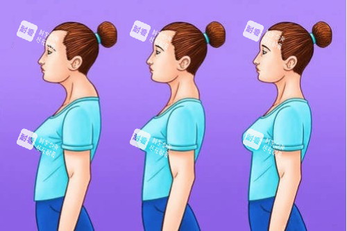 富贵包整形前后对比图 富贵包整形前后对比图