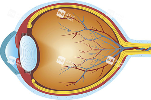 视网膜色素变性眼部状况图