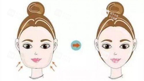 瘦脸效果对比动画图 瘦脸效果对比动画图