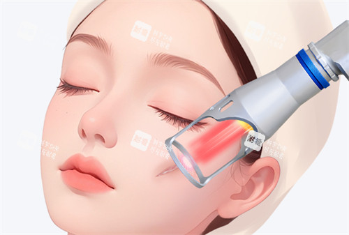 激光去疤怎么样 激光去疤怎么样