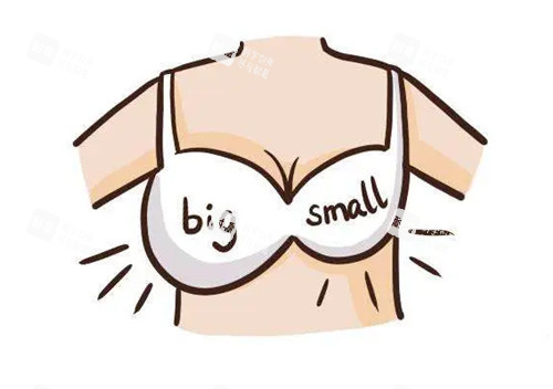 胸部大小不对称卡通示意图