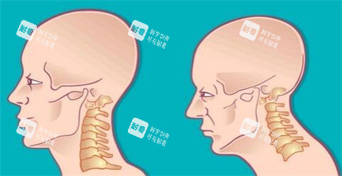 脖子长出富贵包卡通照片图