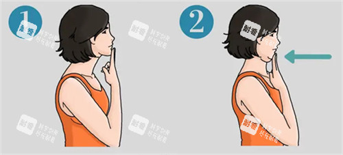 富贵包前后对比 富贵包前后对比