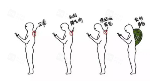 富贵包的形状 富贵包的形状